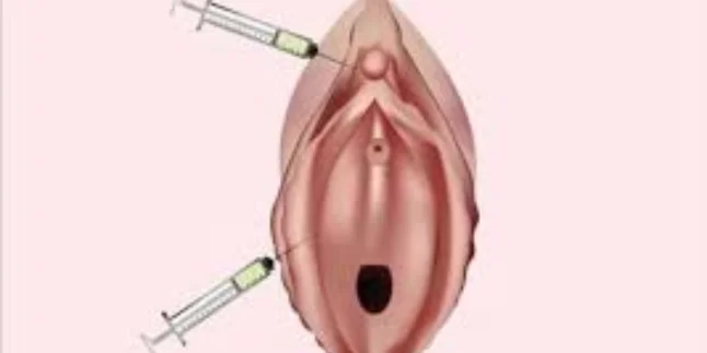O-Shot (Orgasm Shot) Treatment by Dr. Amulya Gumpalli in Madhapur, Hyderabad – Advanced Cosmetic Gynecology Procedure
